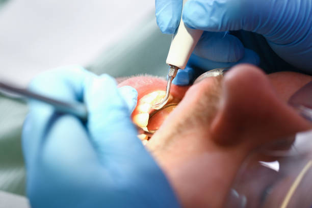 Best Emergency Root Canal Treatment in Mount Hore, WI